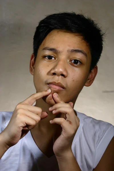 genç yaşında çocuk veya genç sivilce ile