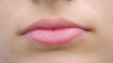 Happy smiling young caucasian girl with braces, close-up view. Lips of casual female. Fun and joy lifestyle, slow motion