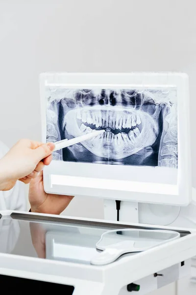 Dentista explicando imagem de raios X para o paciente — Fotografia de Stock