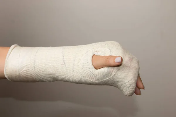 Κυρία Σπασμένο Χέρι Και Καρπό Τυλιγμένη Γύψο — Φωτογραφία Αρχείου
