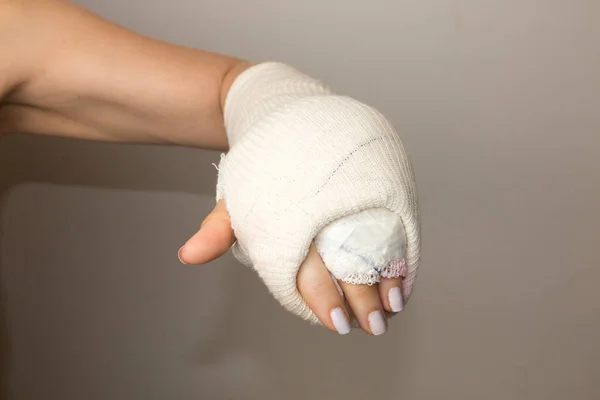 Senhora Com Uma Mão Quebrada Pulso Envolto Elenco — Fotografia de Stock