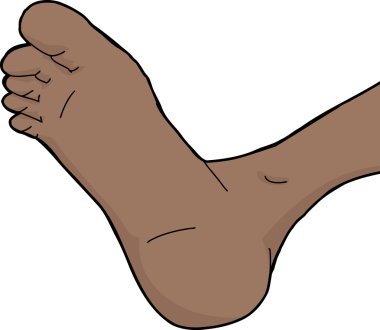 izole ayak sole