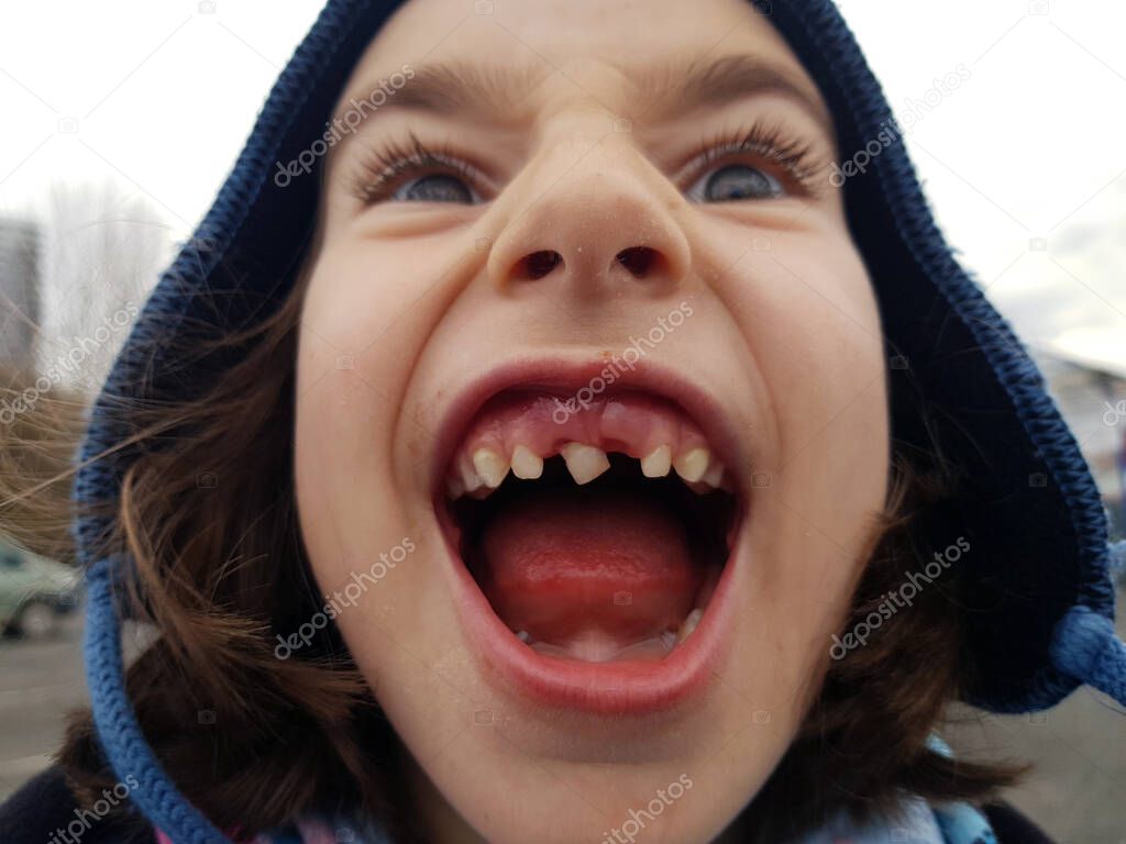 Child smiling and making a grimace showing her missing milk tooth
