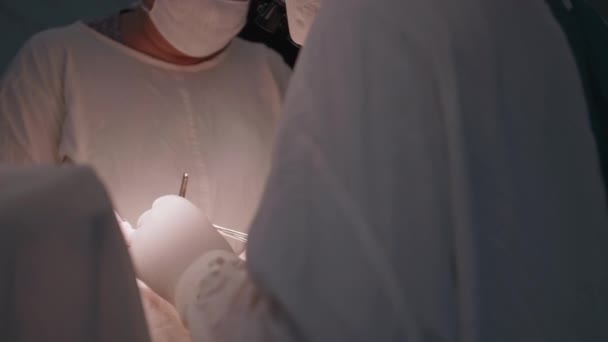 Health care, a complex medical operation under anesthesia on patient heart in operating room, close-up — Wideo stockowe