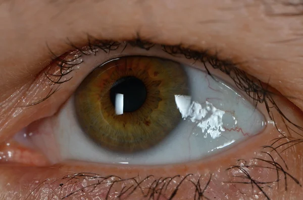 Human eye — Stock Photo, Image