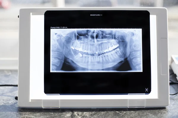 X-Ray Viewer — Stock Photo, Image