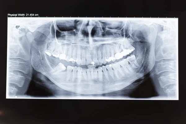 X-ray — стоковое фото