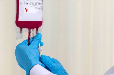 Hastaya kan nakli yapmak için kan torbasını kontrol eden bir doktor..
