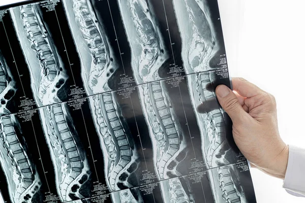 Médico Mirando Imagen Resonancia Magnética Las Espinas — Foto de Stock