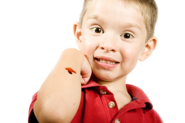 Kid with a boo-boo — Stock Photo, Image