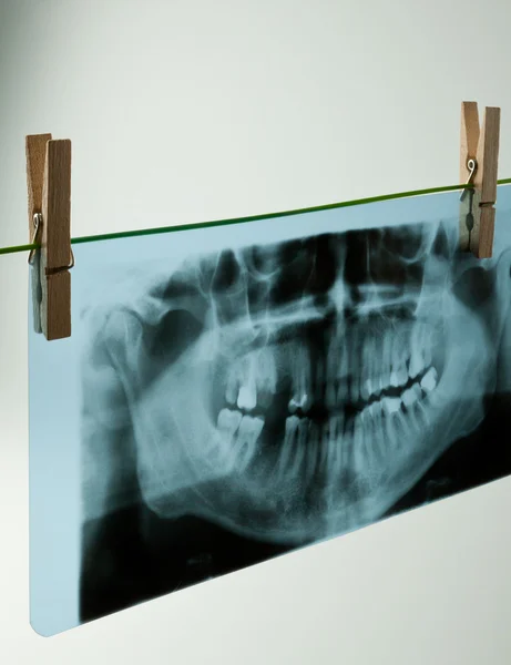 Radiografia dentale — Foto Stock