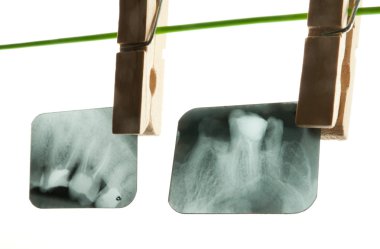 Dental X-ray clipart