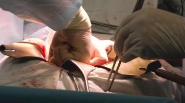 Profesyonel çok ırklı doktorlar hastane odasında ameliyat yapıyor.