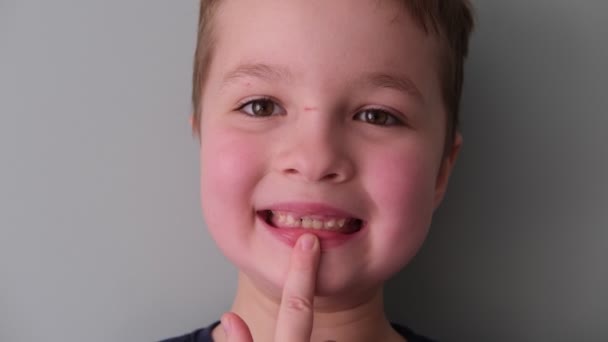 Menino 7 anos de idade mostra sua boca, crescimento, mudança de dentes — Vídeo de Stock