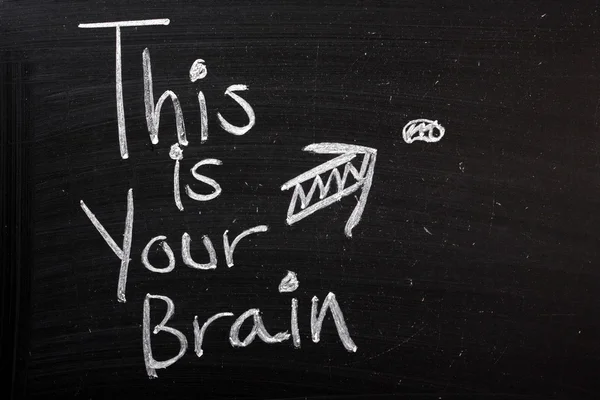 Este es tu cerebro. —  Fotos de Stock