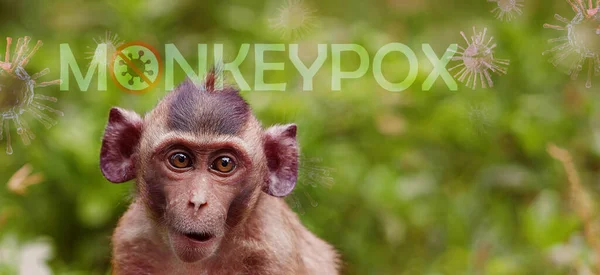 Concepto Brote Monkeypox Varicela Causada Por Virus Varicela Varicela Una — Foto de Stock