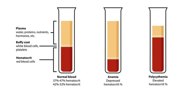 Composición Sangre Plasma Búfalo Hematocrito Orrelación Entre Glóbulos Rojos Eritrocitos — Archivo Imágenes Vectoriales