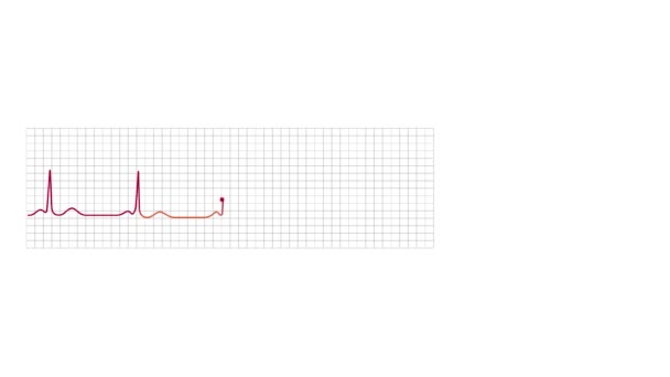 Sinüs Bradikardisi Anormalliğini Gösteren Animasyon Elektrokardiyografi Monitörü Grafiği — Stok video