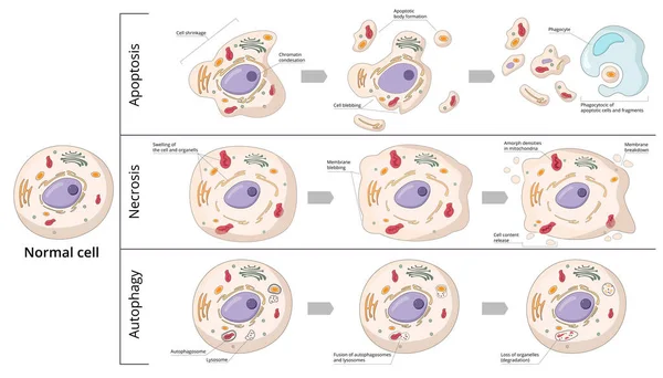 Tre Forme Fondamentali Morte Cellulare Apoptosi Condensazione Cromosomica Frammentazione Nucleare — Vettoriale Stock