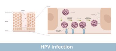HPV enfeksiyonu. Papillomaviridae familyasından gelen bir DNA virüsünün insan papillomavirüs enfeksiyonunun işleme tabi tutulması ve hücre reseptörünün bağlanma aşamaları.