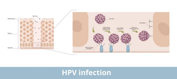 Hpv 유두종 Papillomavirus Dna 바이러스가 유두종 Papillomavirus 노출시키고 수용체 단계를 — 스톡 벡터