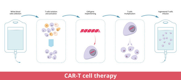 CAR-T cell therapy.Chimeric antigen receptor T cells (also known as CAR T cells) are T cells that have been genetically engineered to produce an artificial T cell receptor for use in immunotherapy
