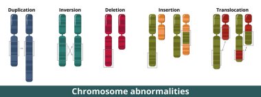 Chromosome abnormalities. Visualization of common chromosomal mutation or disorder. Numerical or structural abnormalities where is a missing, extra, or irregular portion of chromosomal DNA. clipart