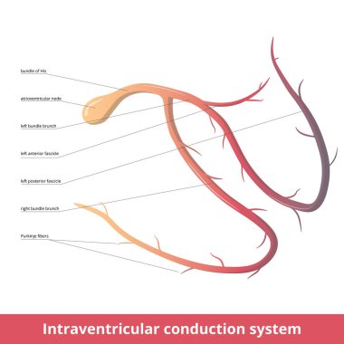 Intraventricular conduction system. Intraventricular (electrical) conduction system of the heart transmits signals generated by the sinoatrial node to cause contraction of muscle:  atrioventricular node, Purkinje fibers, bundle of His