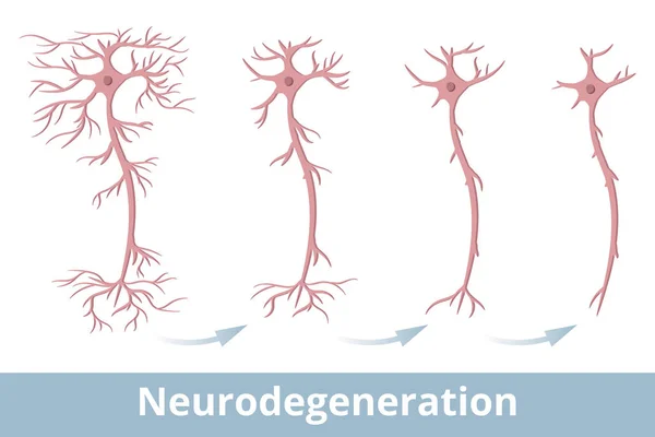 Neurodegeneration Degeneration Nerve Cell Occurs Because Multiple Sclerosis Parkinson Disease — Stock Vector