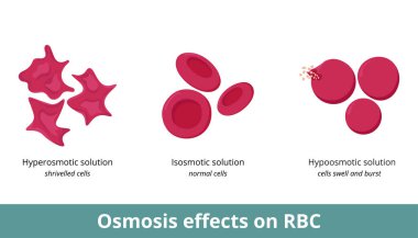 Kırmızı kan hücrelerinde Osmosis etkisi. Çözüm konsantrasyonuna (hiperosmotik, izosmotik veya hipoozmotik) bağlı olarak eritrositler büzülebilir veya şişip patlayabilir.