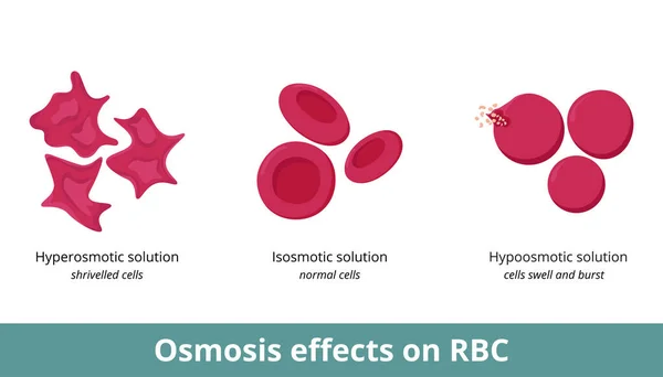 Osmosis Effect Red Blood Cells Depending Solution Concentration Hyperosmotic Isosmotic — Vettoriale Stock