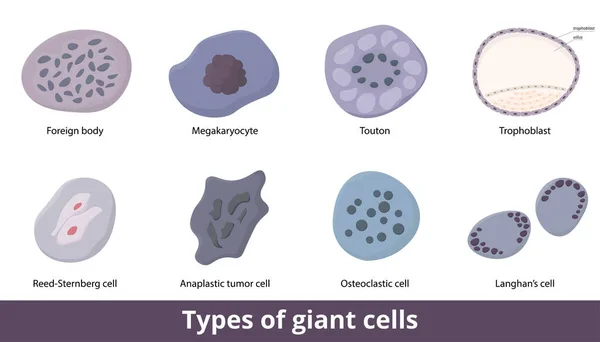 巨大な細胞の種類 8種類の巨大な細胞には Langhan Reed Sternberg細胞 異なる腫瘍細胞 およびトロフブラストが含まれる 正常な炎症性巨大細胞 — ストックベクタ