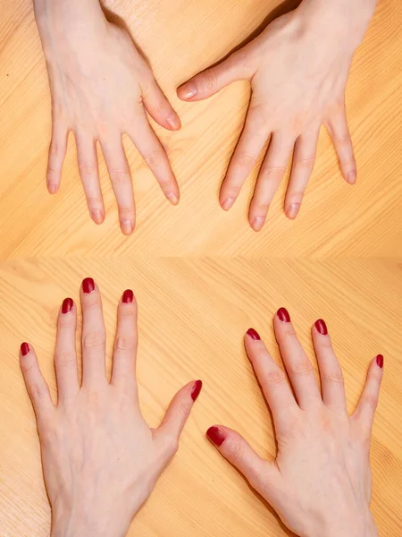 赤い爪のニスとマニキュアの前と後のきれいな爪を持つ女性の手 — ストック写真