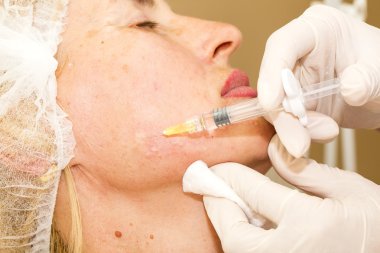 kozmetik tedavisi botox enjeksiyonu ile