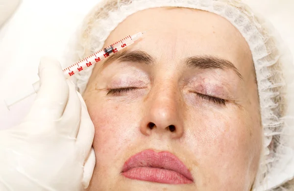 Kosmetische Behandlung mit Botox-Injektion — Stockfoto