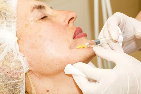 Tratamiento cosmético con inyección de botox —  Fotos de Stock