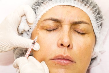 kozmetik tedavisi botox enjeksiyonu ile