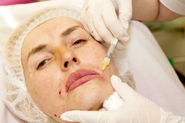 kozmetik tedavisi botox enjeksiyonu ile