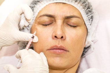 kozmetik tedavisi botox enjeksiyonu ile