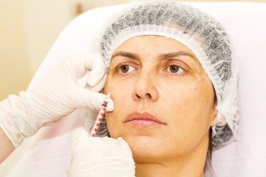 kozmetik tedavisi botox enjeksiyonu ile