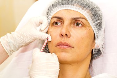 kozmetik tedavisi botox enjeksiyonu ile