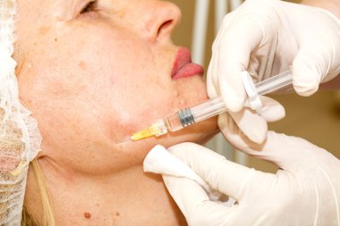 kozmetik tedavisi botox enjeksiyonu ile
