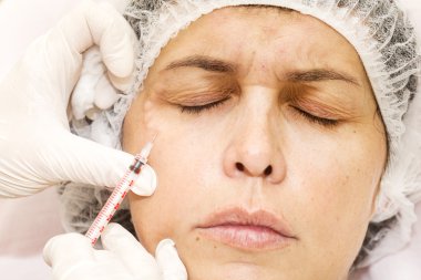 kozmetik tedavisi botox enjeksiyonu ile