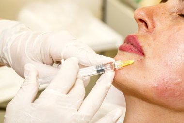 kozmetik tedavisi botox enjeksiyonu ile