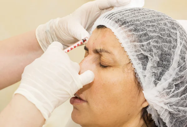 Tratamento cosmético com injeção de botox — Fotografia de Stock