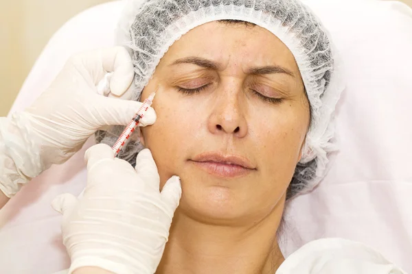 Cosmetic treatment with botox injection — Stock Photo, Image