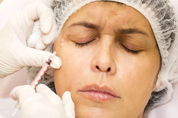 Kozmetik tedavisi botox enjeksiyonu ile — Stok fotoğraf