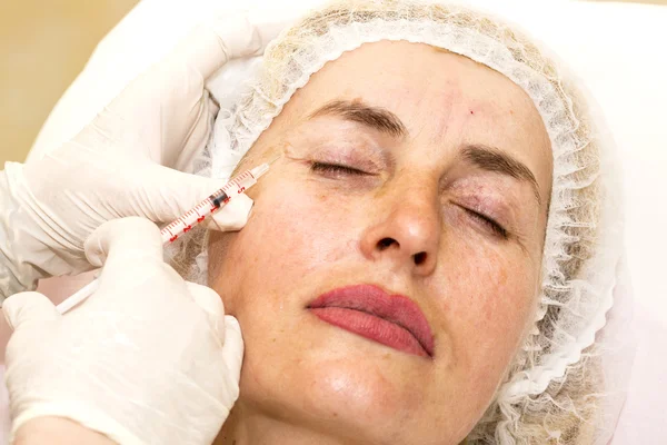 Cosmetic treatment with botox injection — Stock Photo, Image