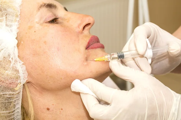 Kosmetické ošetření s botox injekce — Stock fotografie