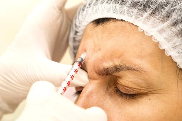 Kozmetik tedavisi botox enjeksiyonu ile — Stok fotoğraf